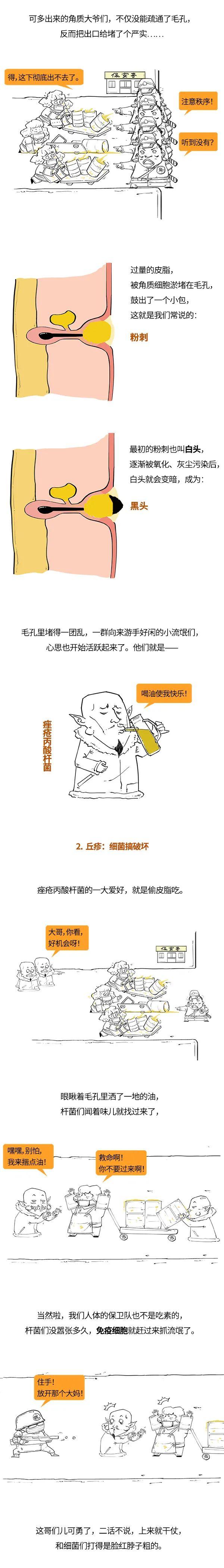 漫画科普：求求你，别“痘”我！
