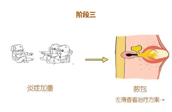 漫画科普：求求你，别“痘”我！