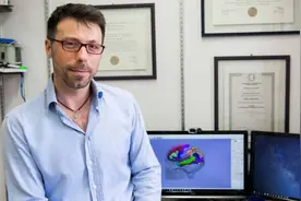 科学家用超声波成功启动了两个处于昏迷状态的人脑图片
