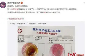 “去医院挂号掏耳朵”上热搜，医生这样说，网友体验后直呼：太爽了图片