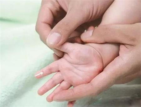 瀛╁瓙鍐鈥滄箍鐤光€濋鍙戯紵鍙兘鏄壒搴旀€х毊鐐? onerror=