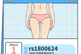 女生大腿根上的纹路，究竟是什么？图片