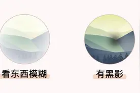 同仁医生：4个眼科测试图，1分钟测眼睛是否健康图片