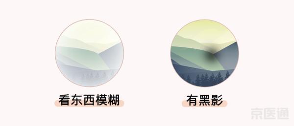 散光轴位的自测方法（同仁医生4个眼科测试图）