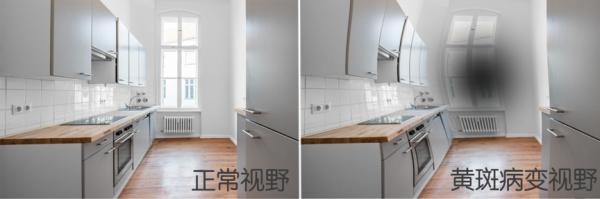 同仁医生：4个眼科测试图，1分钟测眼睛是否健康
