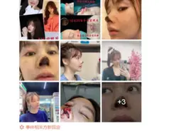 中央政法委评演员整容失败：整容并非“容貌焦虑”的救命稻草图片