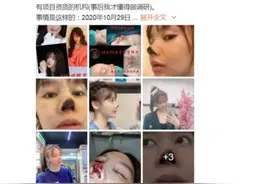 中央政法委评演员整容失败：整容并非“容貌焦虑”的救命稻草图片