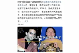 美国成功完成首例换脸换手联合移植手术！其实“换脸”早已成真，但伦理困境仍在图片
