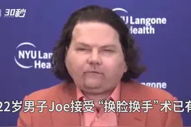 30秒 | 全球首例！美国男子车祸毁容换掉全脸和双手视频封面