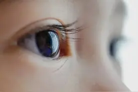 这种情况的儿童散光可能会变弱视！看电子屏幕多了会加重散光吗？图片