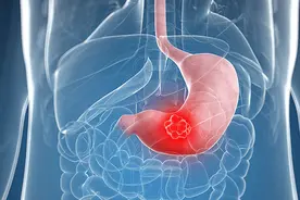 幽门螺杆菌是如何导致胃癌的？视频封面