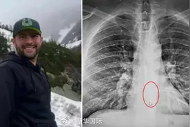 睡觉误吞无线耳机 美国男子这是啥操作图片