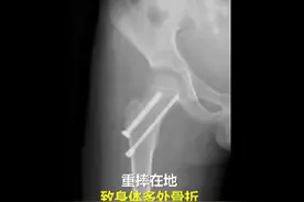 男孩模仿动画片撑伞从4楼跳下骨折，孩子缺少辨识力，家长们要牢记这些图片