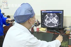 大学生味觉嗅觉不断丧失 原因竟在鼻腔里...图片