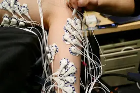 MIT开发新型截肢手术方式 让患者更好“感觉”到假肢图片
