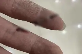 隔着屏幕都疼！不敢看……图片