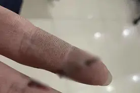 隔着屏幕都疼！不敢看……图片