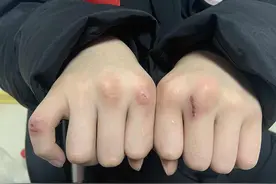 一个拳击少年的日常：夺冠后接着挡教练的重拳图片