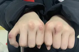 一个拳击少年的日常：夺冠后接着挡教练的重拳图片