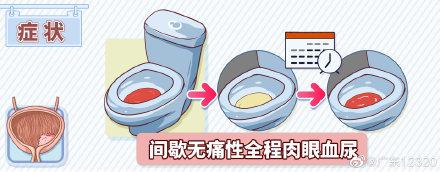 膀胱癌一般有哪些症状（膀胱癌的典型症状是什么）