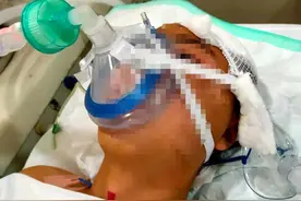 上拳击课被打成二级重伤，教练被警方立案图片