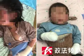 揪心！湖南浏阳小姐弟双双被烧伤，家中这个隐患一定要重视图片