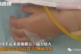2岁女童误吞9颗磁力珠，家长想了一招，结果事大了图片