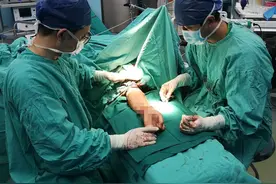 操作失误男子左手被连腕切断，经三小时手术接回恢复部分功能图片