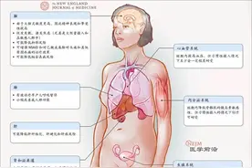 喝下一杯咖啡 7个器官起变化图片