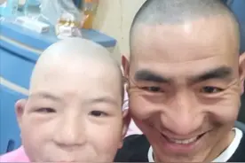 河南一父亲陪烧伤女儿一起剃光头，网友：父爱如山，感动图片