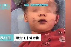 男孩吃蛋糕后嘴巴被染黑，姥爷怀疑蛋糕色素超标：洗了两天才洗掉图片