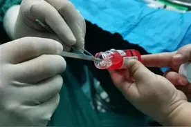 6小时的“光明接力”武汉老人眼角膜捐给郑州花季少女图片