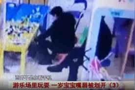 痛心！一岁男童在游乐场玩耍时受伤，缝了20多针图片