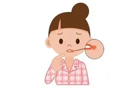 嘴巴经常起泡竟是“单纯疱疹”病毒感染！还会互相传染图片