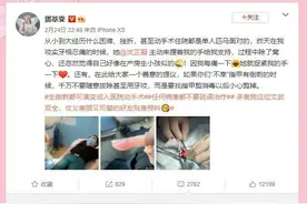 后宫剧大女主、明星邓萃雯拔倒刺“拔”进医院手术 华西专家教你正确处理图片