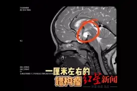一岁多的女童来例假了？而且乳房也增大 医生：与性早熟有关图片