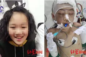 继母虐打12岁女童致脑梗死被公诉：检方指控其犯虐待罪、故意伤害罪图片