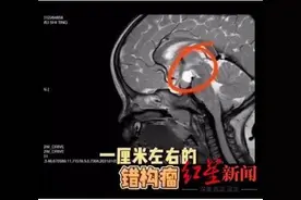 一岁多的女孩来例假了？医生提醒图片