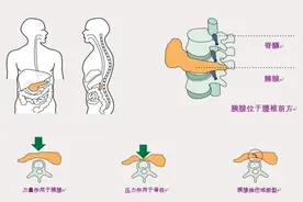 小撞击可能有大隐患 被方向盘撞到腹部后应警惕胰腺内伤图片