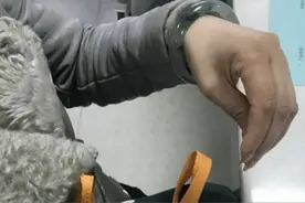 女子跟丈夫吵架后双手变“鸡爪”，医生：这是“气到中毒了”图片