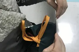 妻子与丈夫吵架后手指痉挛如鸡爪，医生：是气到“中毒”图片