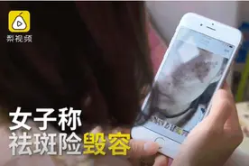 花了3万做激光，才彻底懂了：医生为什么劝你别去斑图片