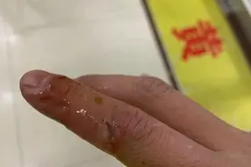哈尔滨一女童惊厥送医途中咬舌头，交警说了这样一句话很暖心图片