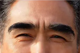 眉毛突然变长？是长寿的特征，还是身体出问题了？图片