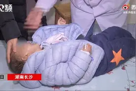 长沙3岁男孩一晒太阳就脱皮，检查后医生直呼罕见图片