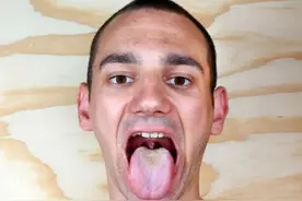 脾胃虚弱会导致舌头胖大，需要引起一定的重视图片