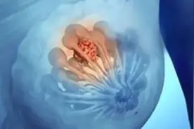 “三八”女神节丨女性一生重要的5个阶段，专家提醒：这样呵护乳房图片