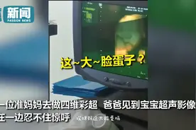准妈妈临产前做彩超想看孩子长啥样 爸爸看到图像接连感叹笑喷网友图片