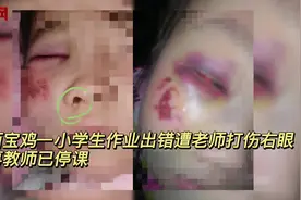 陕西宝鸡一小学生作业出错遭老师打伤右眼 涉事教师已停课图片