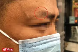 美容馆311元就能立体纹眉，西安男子刚躺下，店家就变脸了……图片